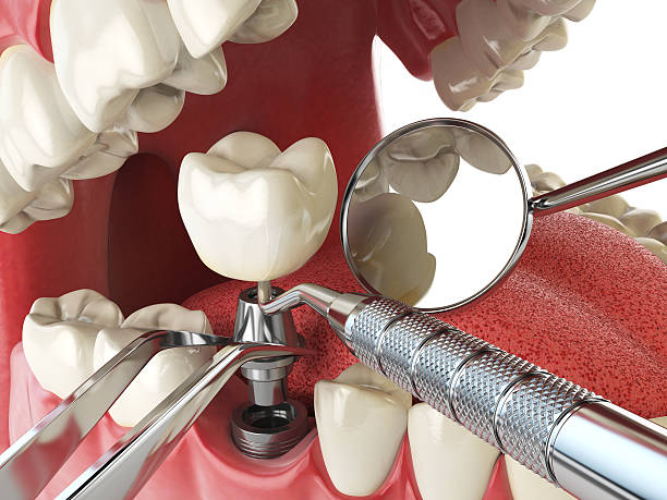 Best Walk-In Emergency Dental Services in Bell Nyon, CA